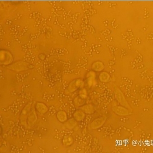实验室细胞污染常见类型及解决方案